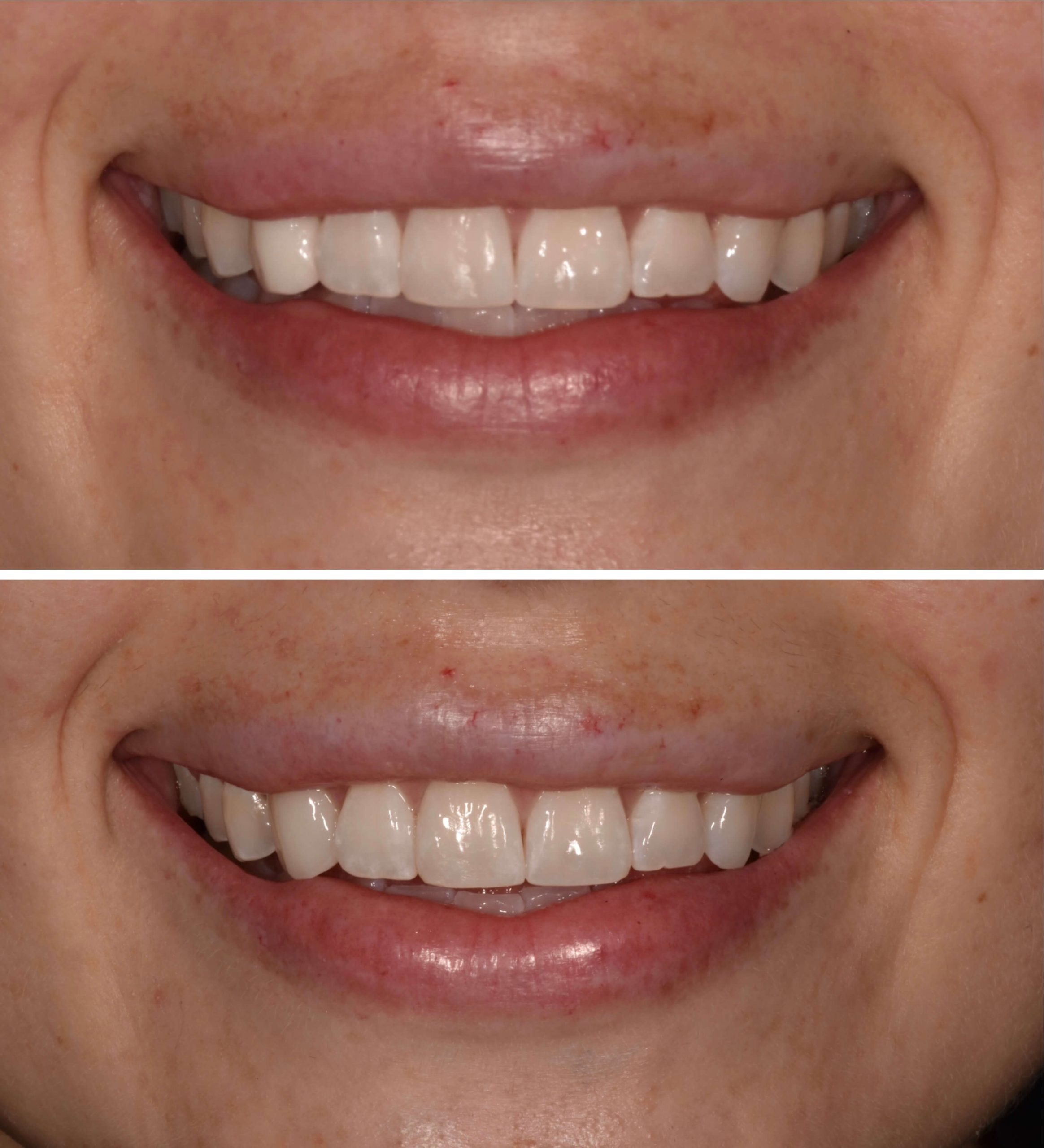 Yorba Linda Elite Dental