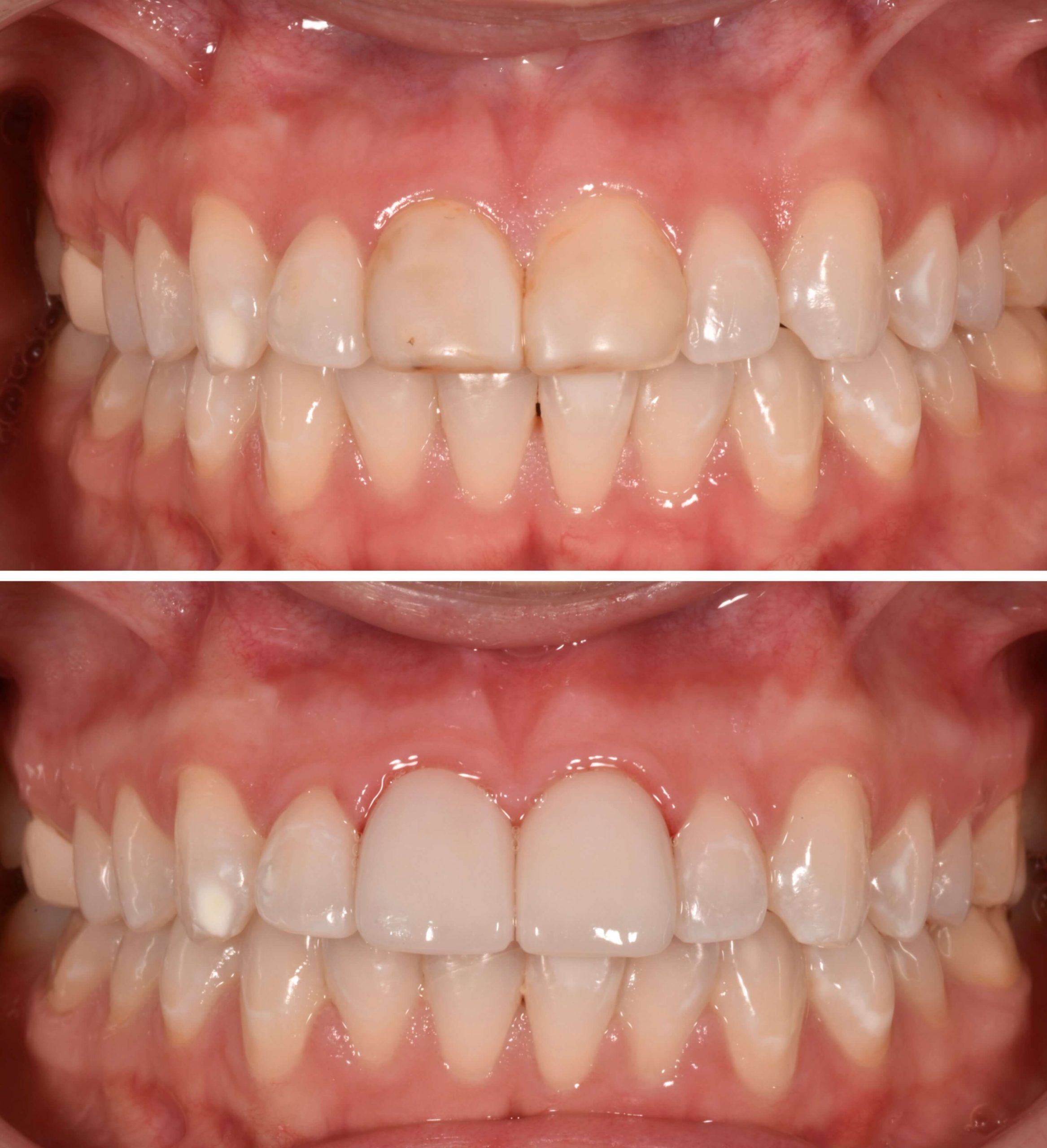 Yorba Linda Elite Dental