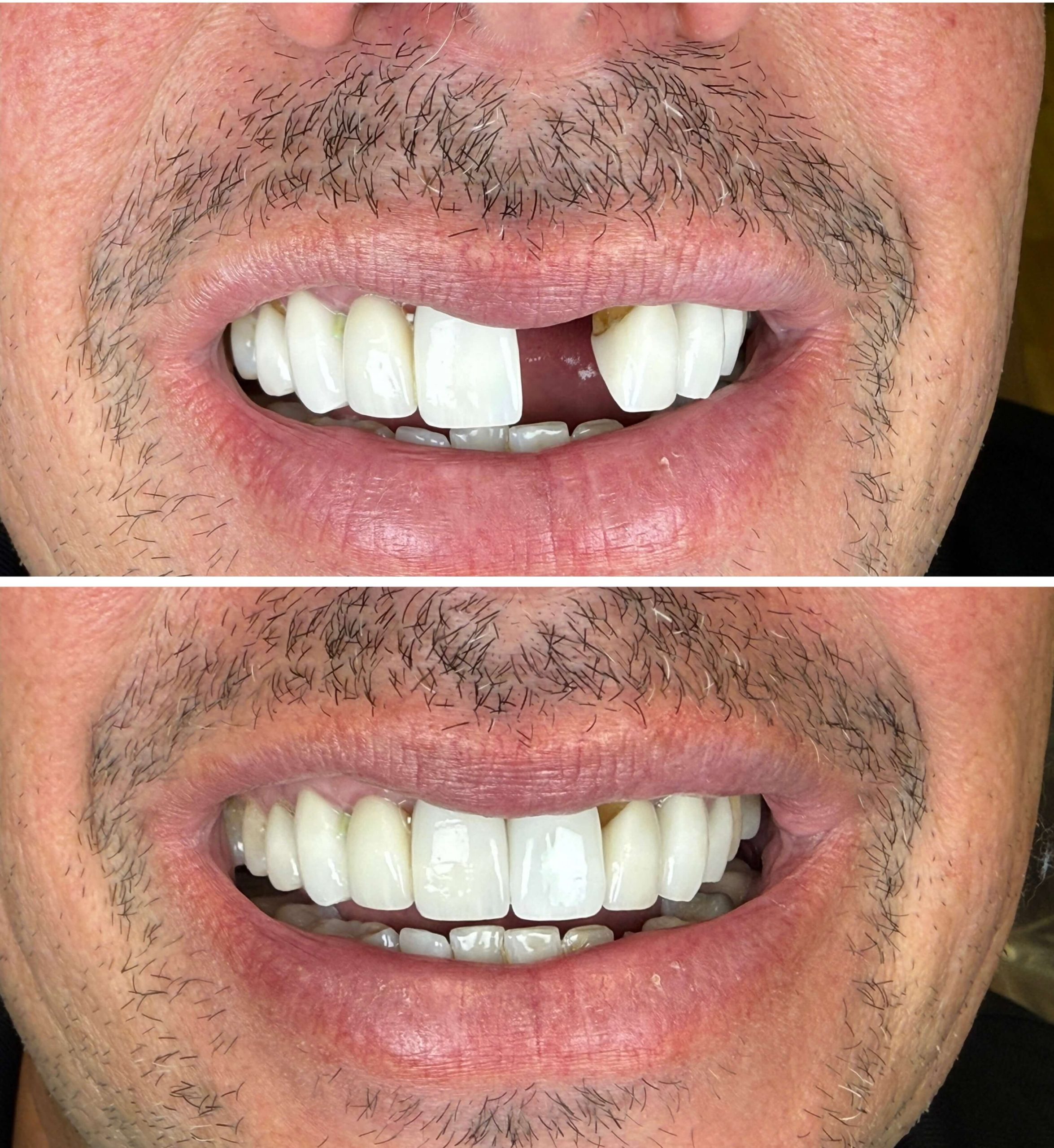 Yorba Linda Elite Dental