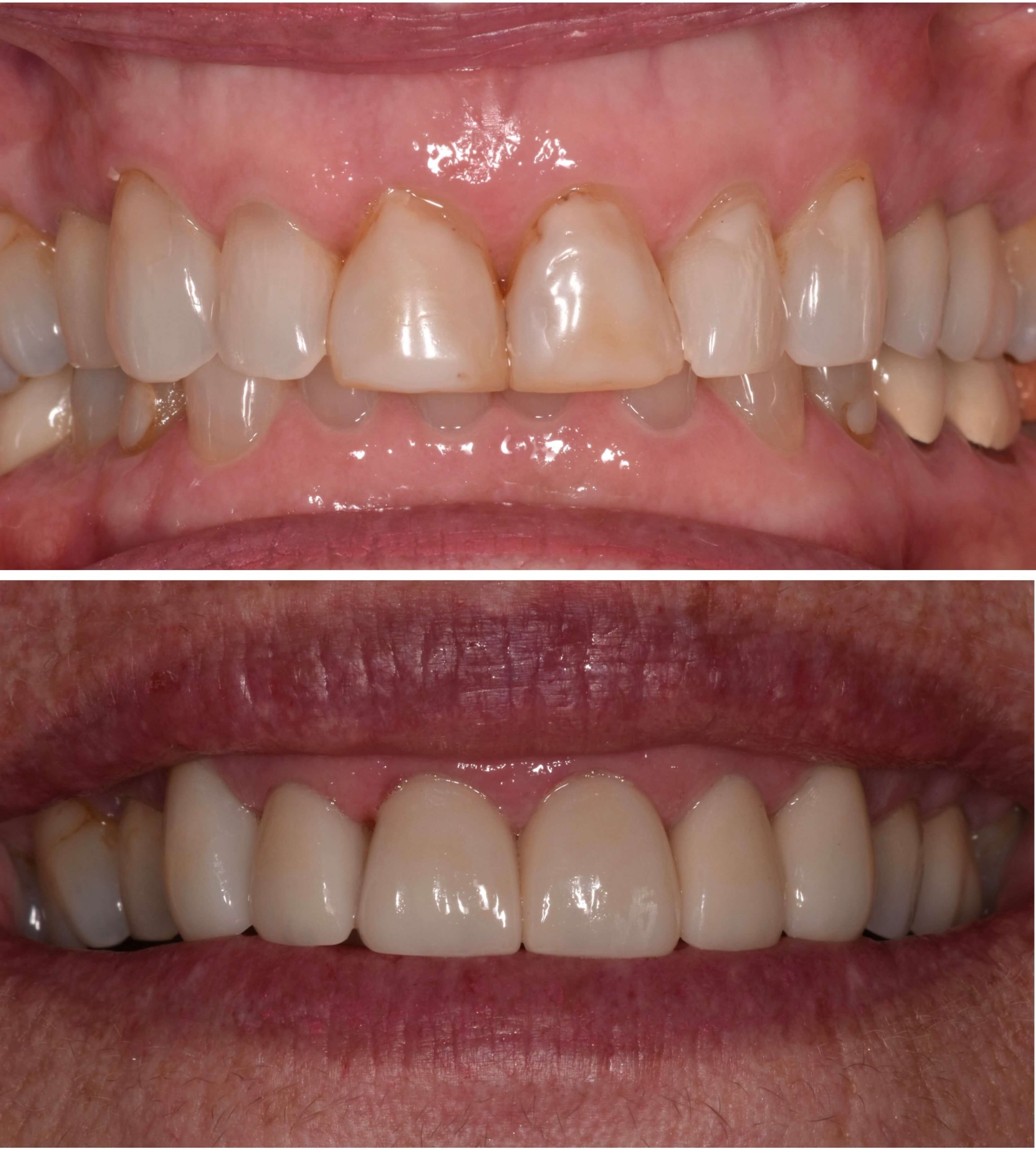 Yorba Linda Elite Dental